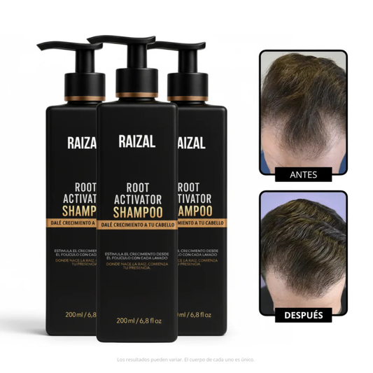 RAIZAL™ - Shampoo Activador de Raíces Capilares